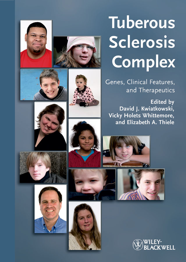 Обложка книги «Tuberous Sclerosis Complex. Genes, Clinical Features and Therapeutics»
