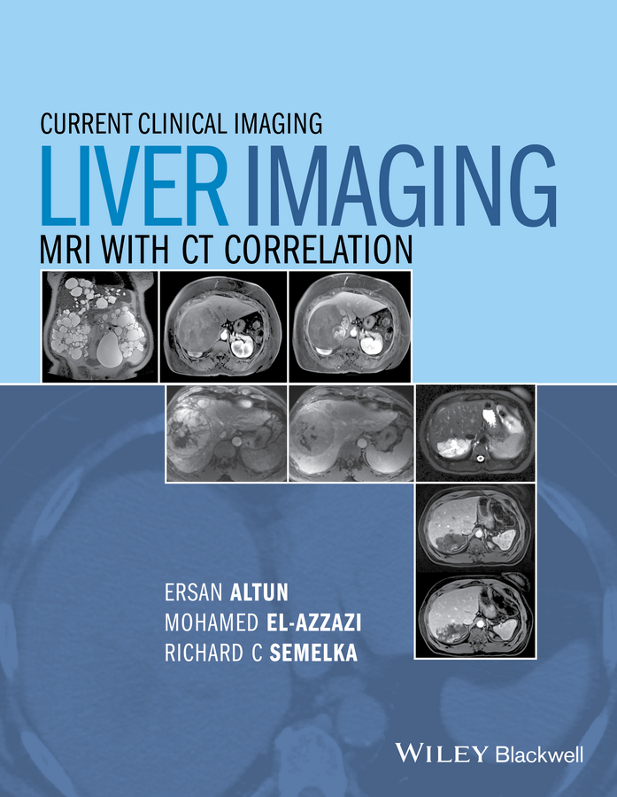 Обложка книги «Liver Imaging. MRI with CT Correlation»