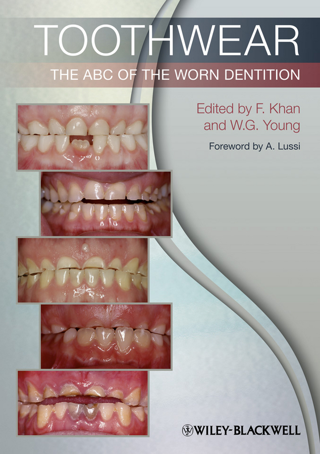 Обложка книги «Toothwear. The ABC of the Worn Dentition»