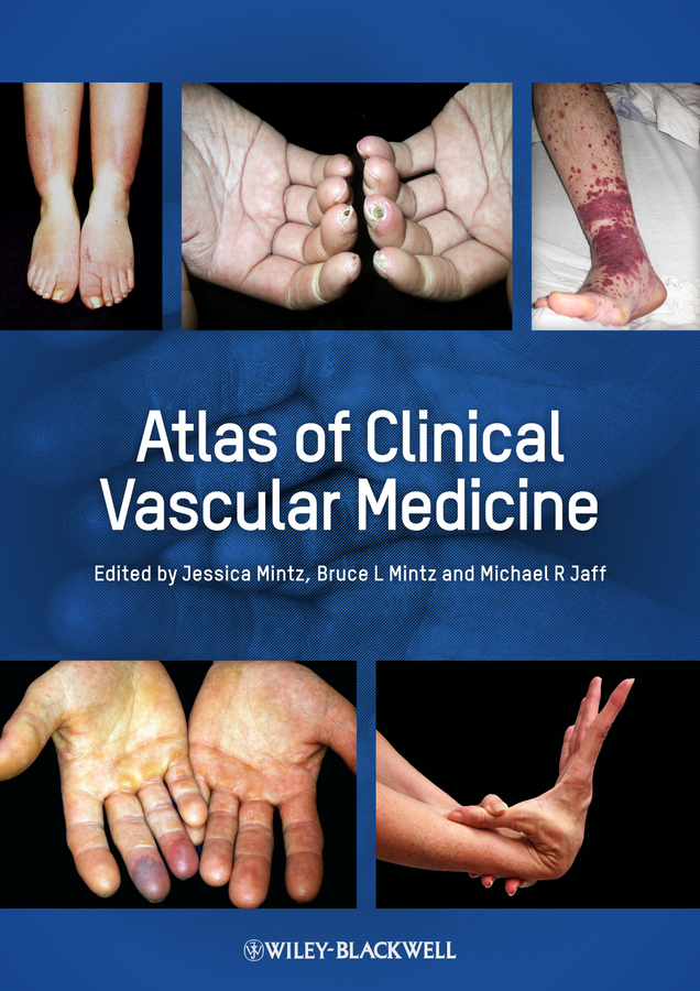 Обложка книги «Atlas of Clinical Vascular Medicine»