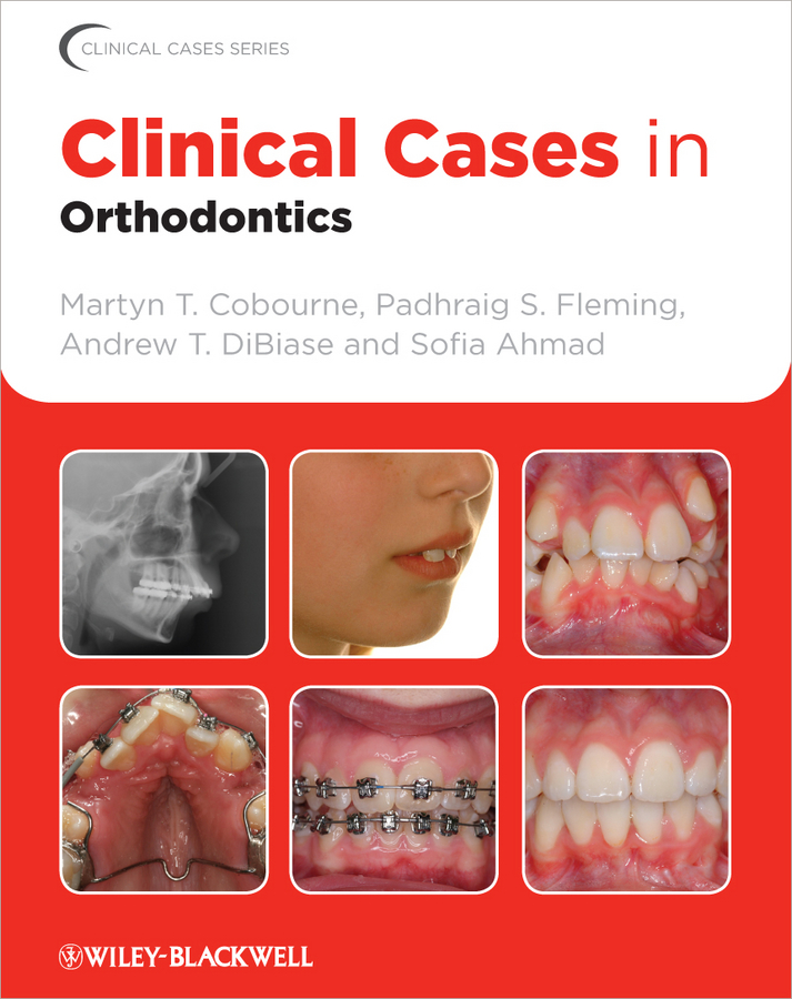 Обложка книги «Clinical Cases in Orthodontics»