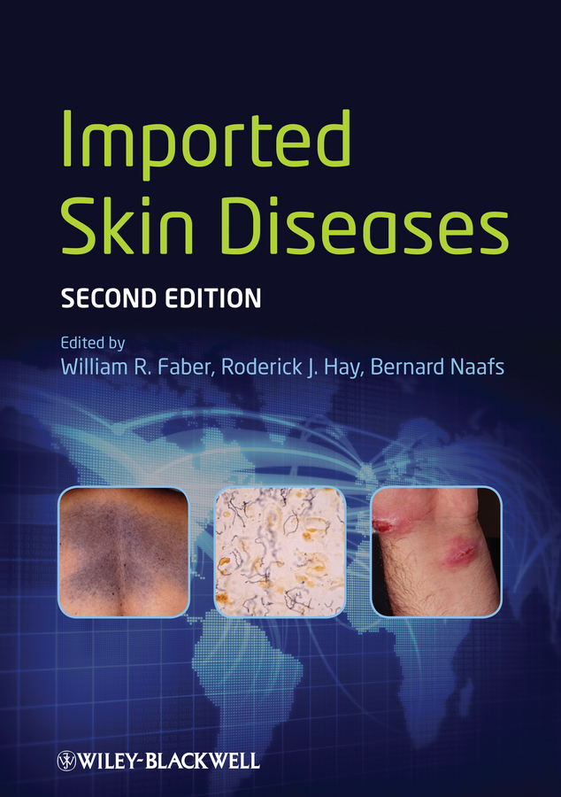 Обложка книги «Imported Skin Diseases»