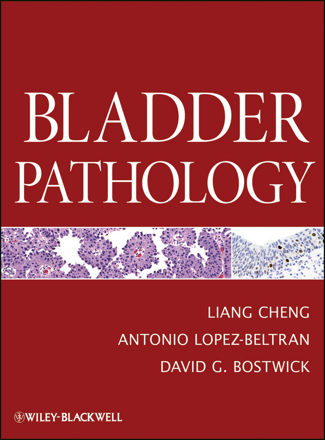 Обложка книги «Bladder Pathology»