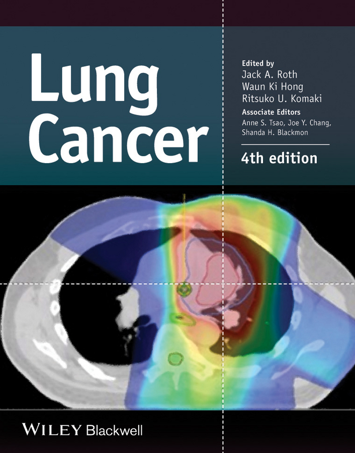 Обложка книги «Lung Cancer»