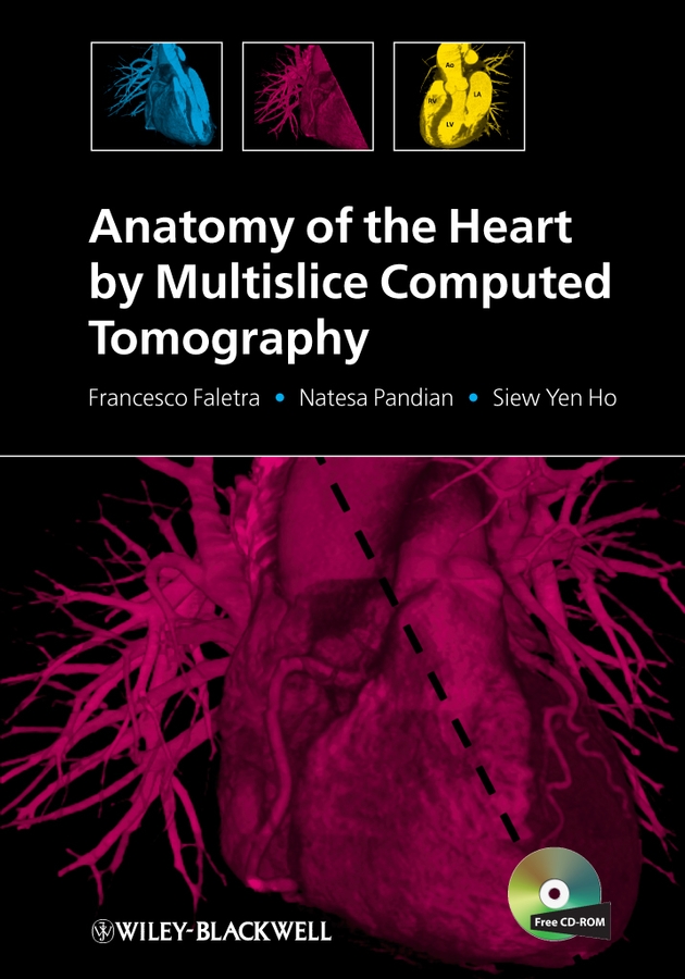 Обложка книги «Anatomy of the Heart by Multislice Computed Tomography»