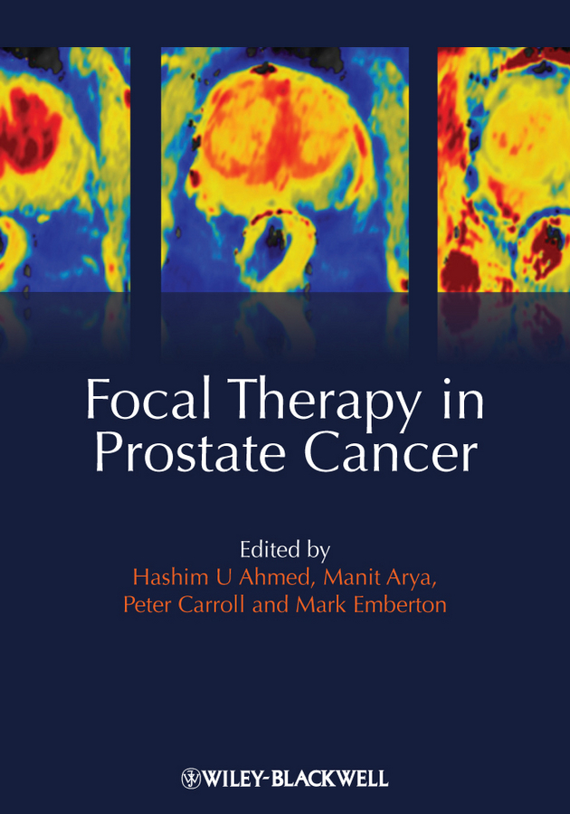 Обложка книги «Focal Therapy in Prostate Cancer»
