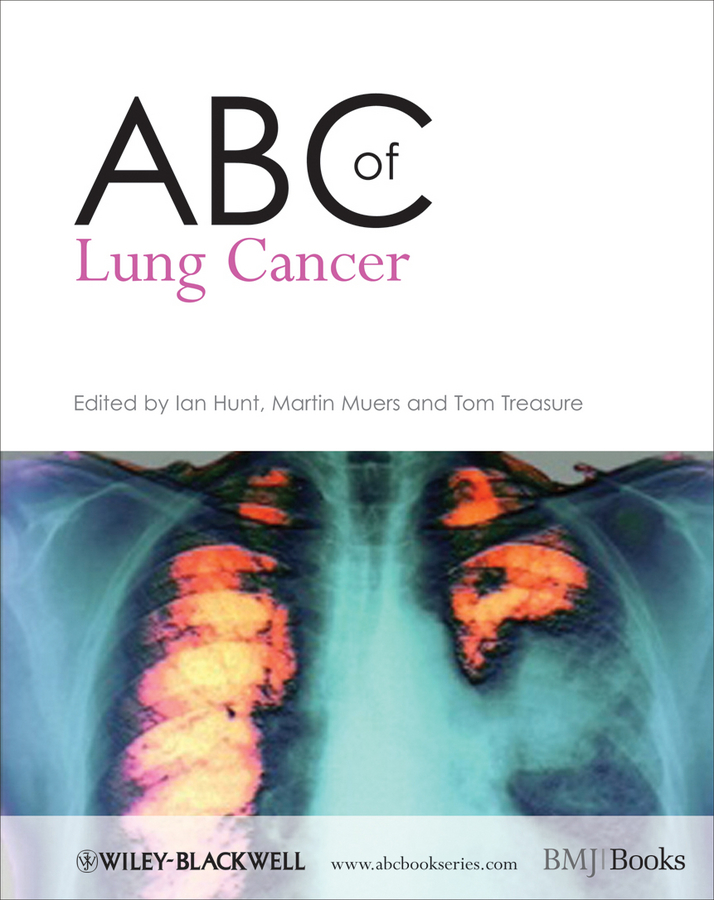 Обложка книги «ABC of Lung Cancer»