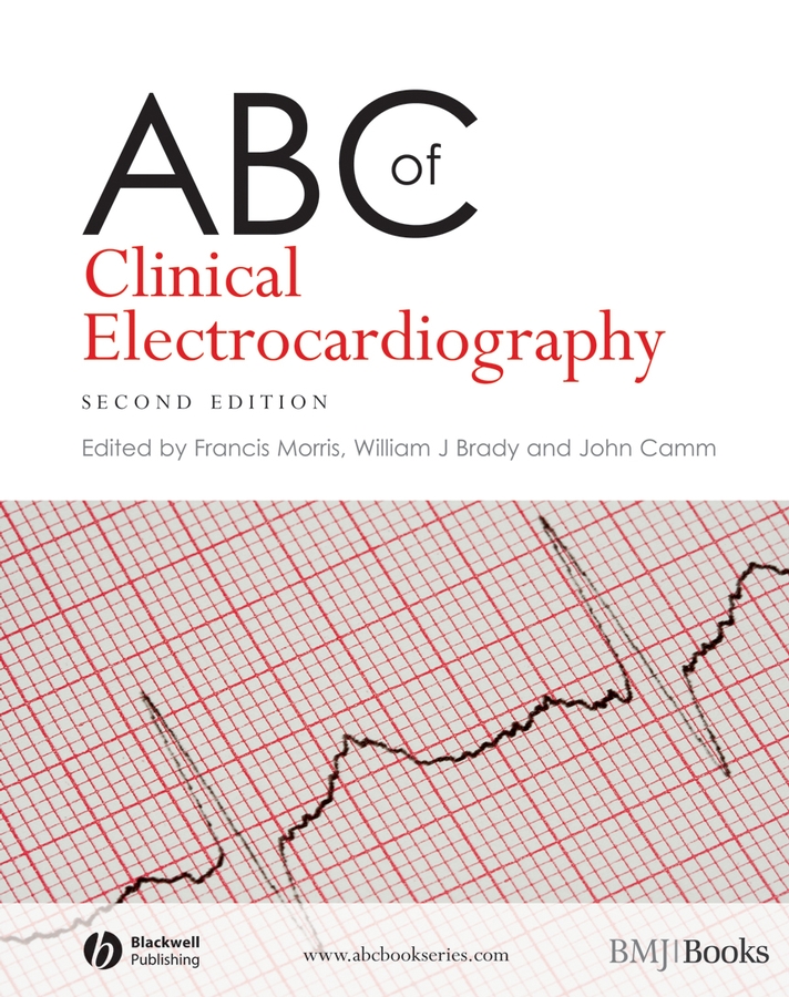 Обложка книги «ABC of Clinical Electrocardiography»
