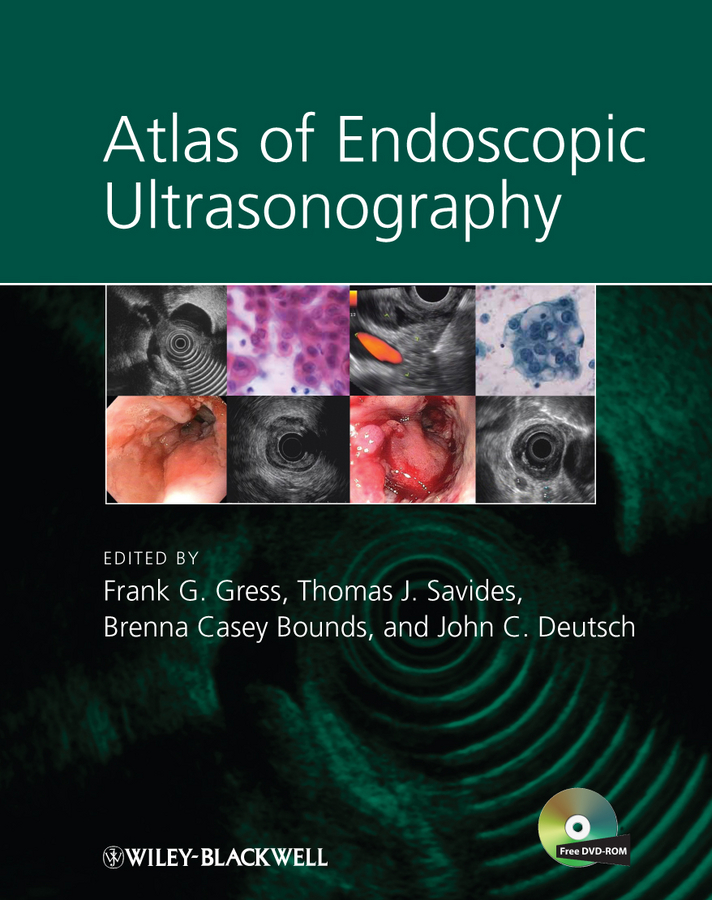 Обложка книги «Atlas of Endoscopic Ultrasonography»