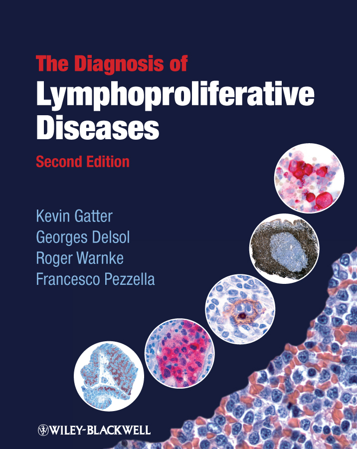 Обложка книги «The Diagnosis of Lymphoproliferative Diseases»