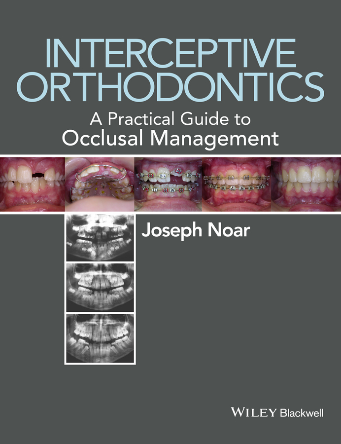 Обложка книги «Interceptive Orthodontics. A Practical Guide to Occlusal Management»