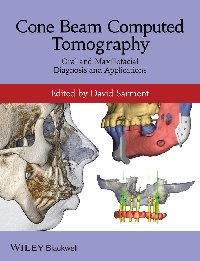 Обложка книги «Cone Beam Computed Tomography. Oral and Maxillofacial Diagnosis and Applications»