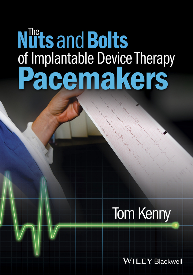 Обложка книги «The Nuts and Bolts of Implantable Device Therapy. Pacemakers»
