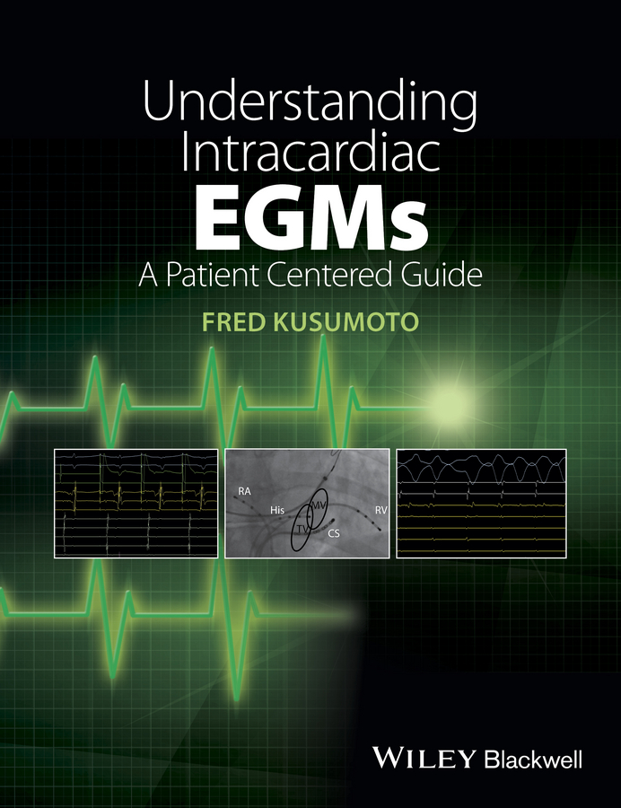 Обложка книги «Understanding Intracardiac EGMs. A Patient Centered Guide»