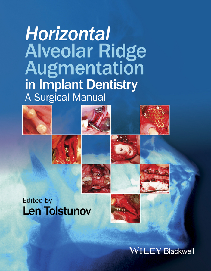Обложка книги «Horizontal Alveolar Ridge Augmentation in Implant Dentistry. A Surgical Manual»