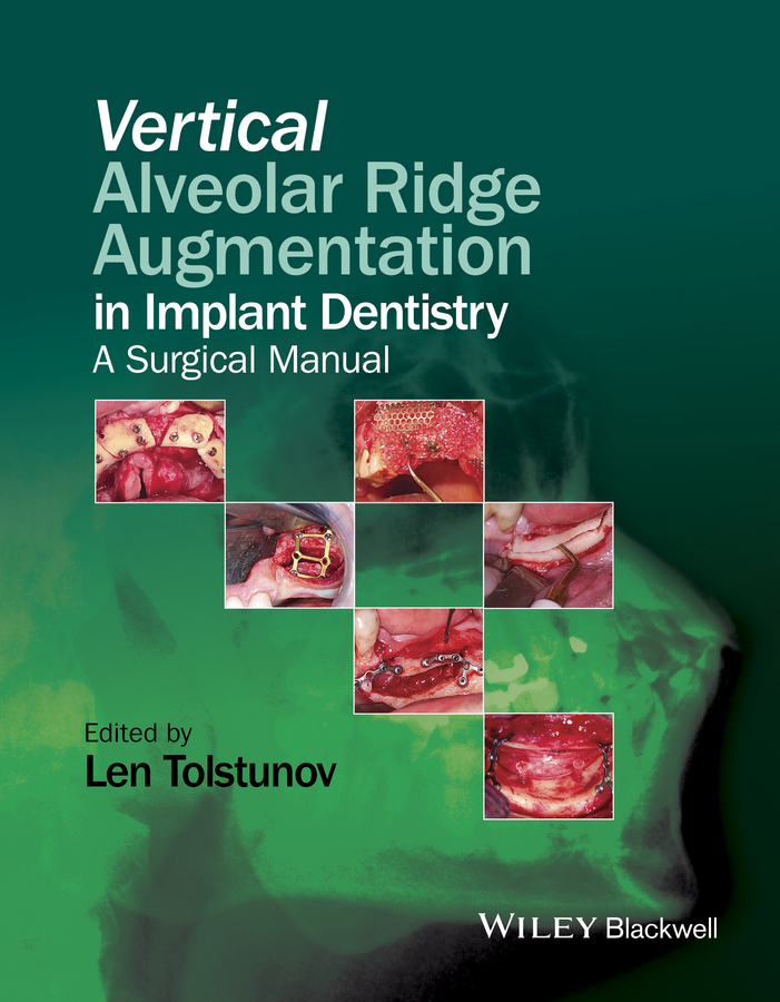 Обложка книги «Vertical Alveolar Ridge Augmentation in Implant Dentistry. A Surgical Manual»