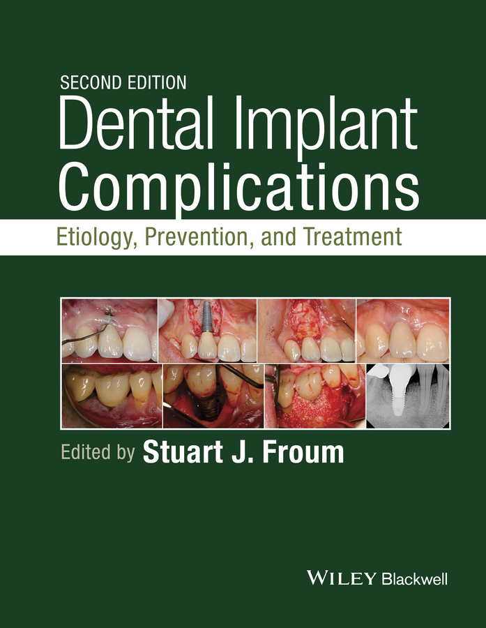Обложка книги «Dental Implant Complications. Etiology, Prevention, and Treatment»