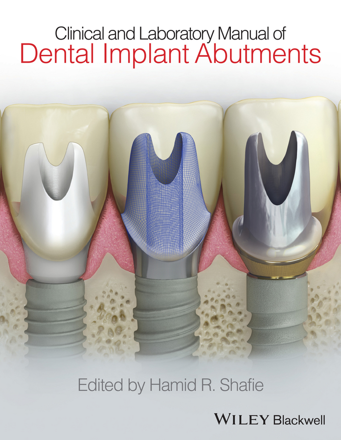 Обложка книги «Clinical and Laboratory Manual of Dental Implant Abutments»