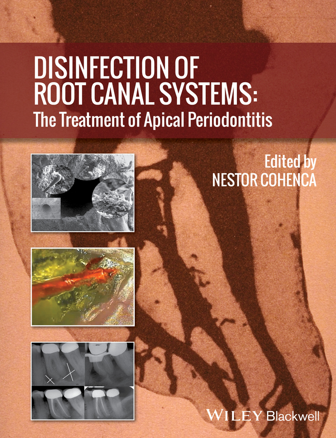 Обложка книги «Disinfection of Root Canal Systems. The Treatment of Apical Periodontitis»