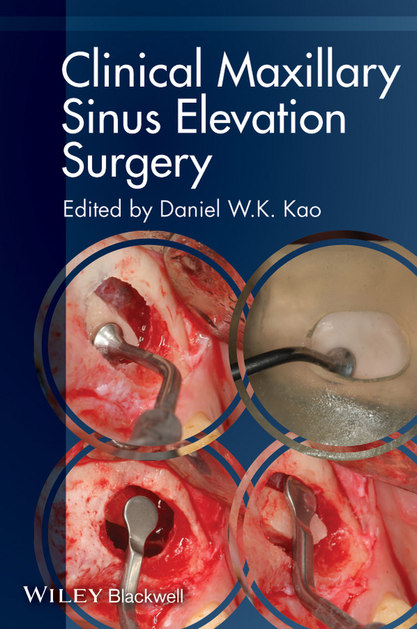 Обложка книги «Clinical Maxillary Sinus Elevation Surgery»