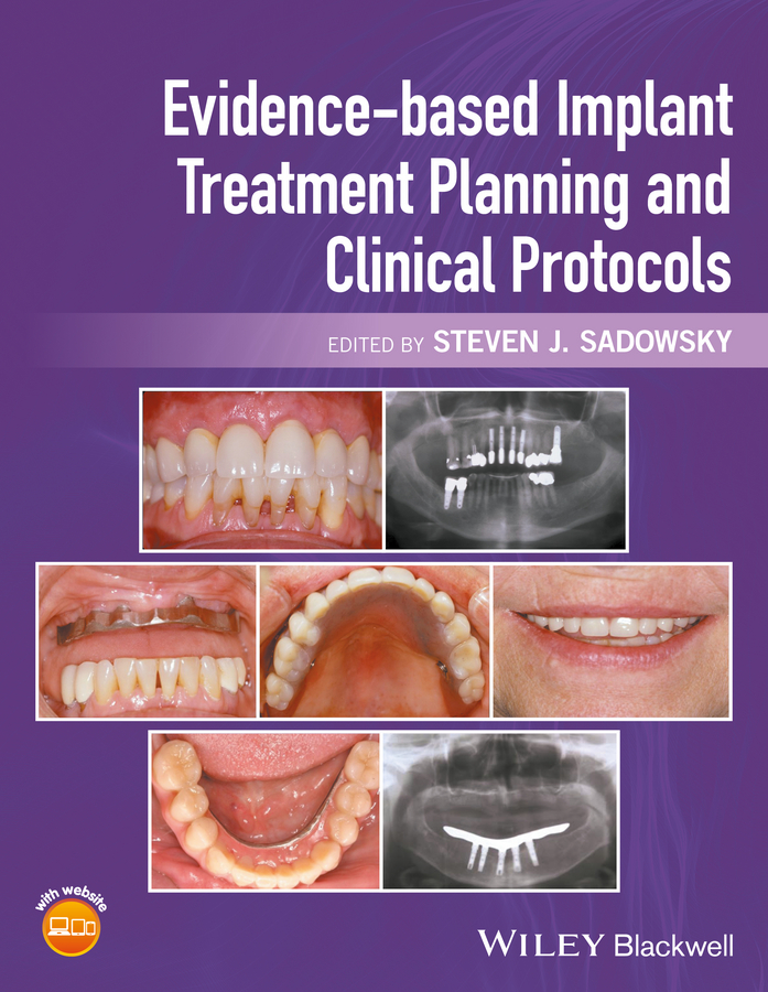 Обложка книги «Evidence-based Implant Treatment Planning and Clinical Protocols»