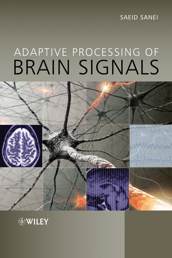 Обложка книги «Adaptive Processing of Brain Signals»