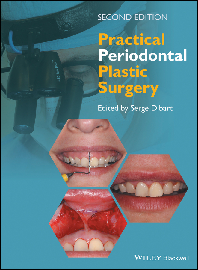 Обложка книги «Practical Periodontal Plastic Surgery»
