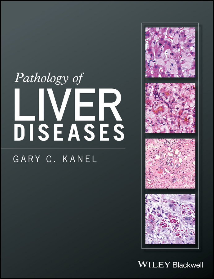 Обложка книги «Pathology of Liver Diseases»
