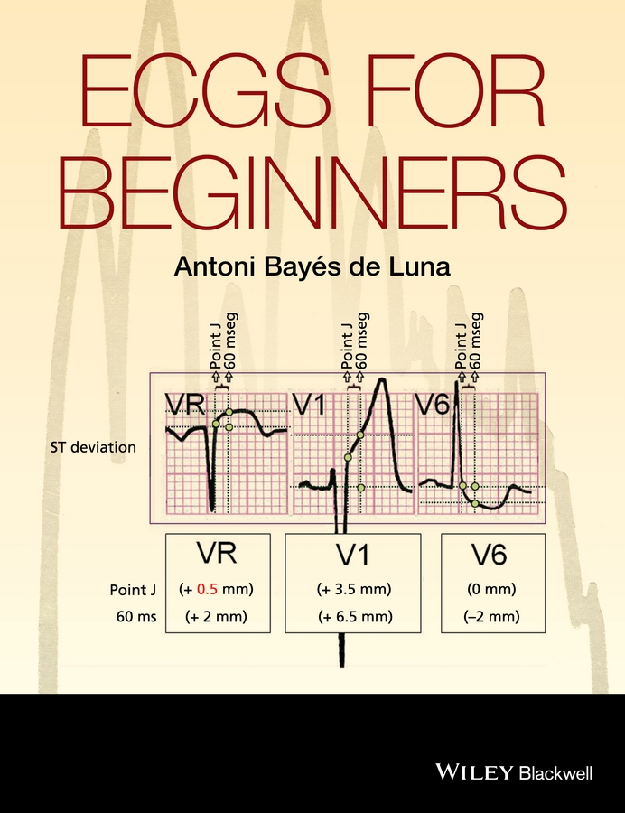 Обложка книги «ECGs for Beginners»