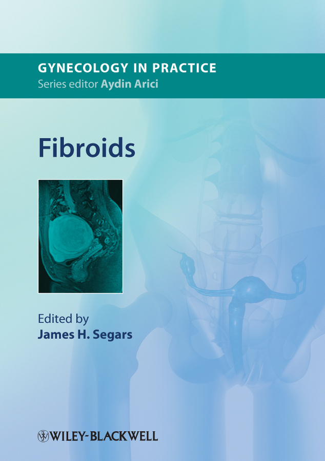 Обложка книги «Fibroids»