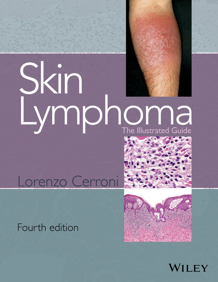 Обложка книги «Skin Lymphoma. The Illustrated Guide»