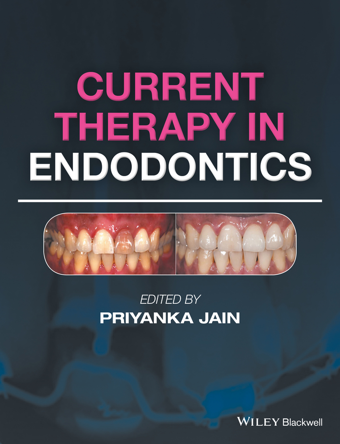 Обложка книги «Current Therapy in Endodontics»