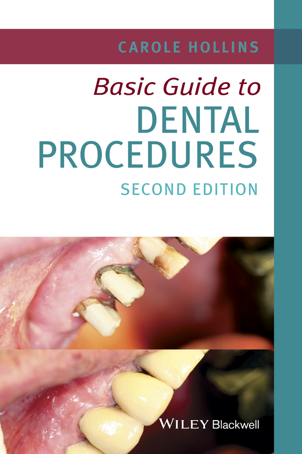 Обложка книги «Basic Guide to Dental Procedures»