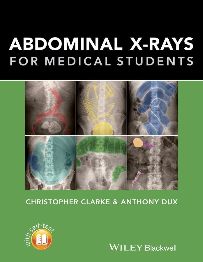 Обложка книги «Abdominal X-rays for Medical Students»