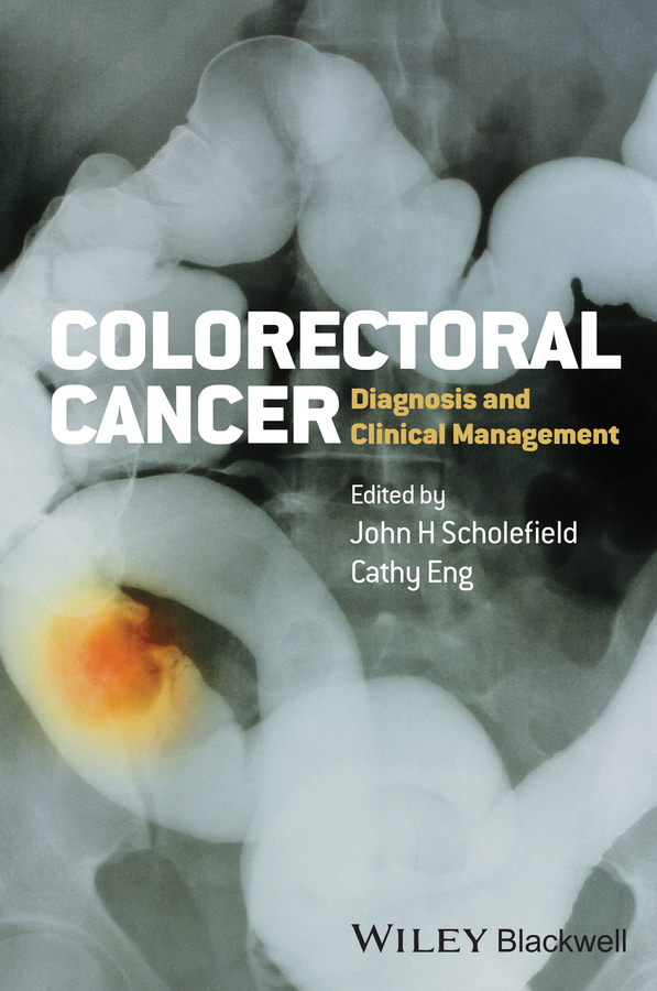 Обложка книги «Colorectal Cancer. Diagnosis and Clinical Management»