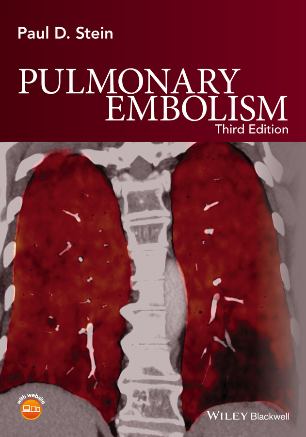 Обложка книги «Pulmonary Embolism»