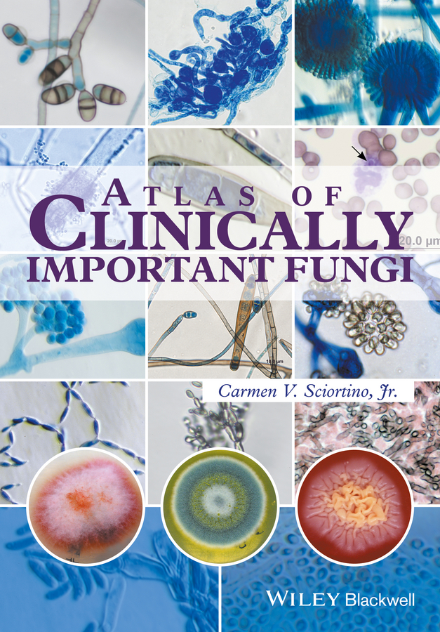 Обложка книги «Atlas of Clinically Important Fungi»