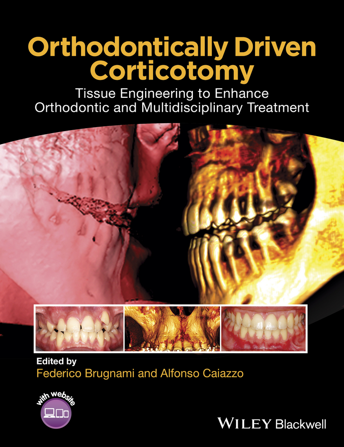 Обложка книги «Orthodontically Driven Corticotomy. Tissue Engineering to Enhance Orthodontic and Multidisciplinary Treatment»