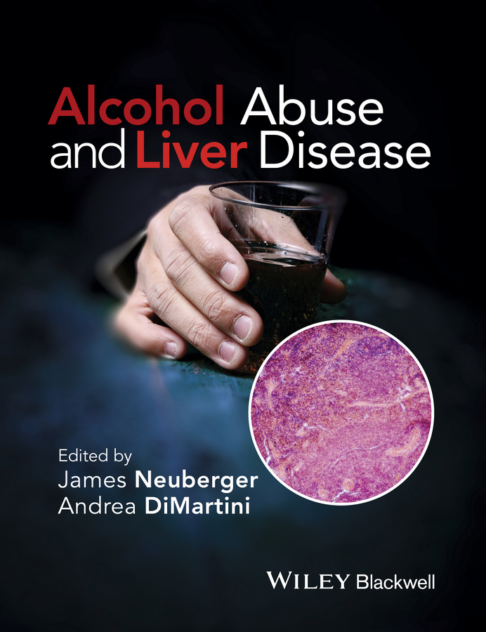 Обложка книги «Alcohol Abuse and Liver Disease»