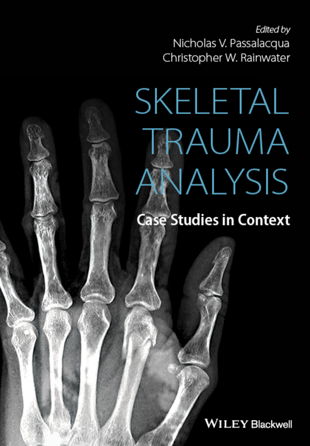 Обложка книги «Skeletal Trauma Analysis. Case Studies in Context»