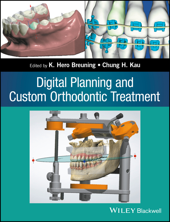 Обложка книги «Digital Planning and Custom Orthodontic Treatment»
