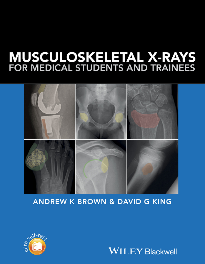 Обложка книги «Musculoskeletal X-Rays for Medical Students and Trainees»
