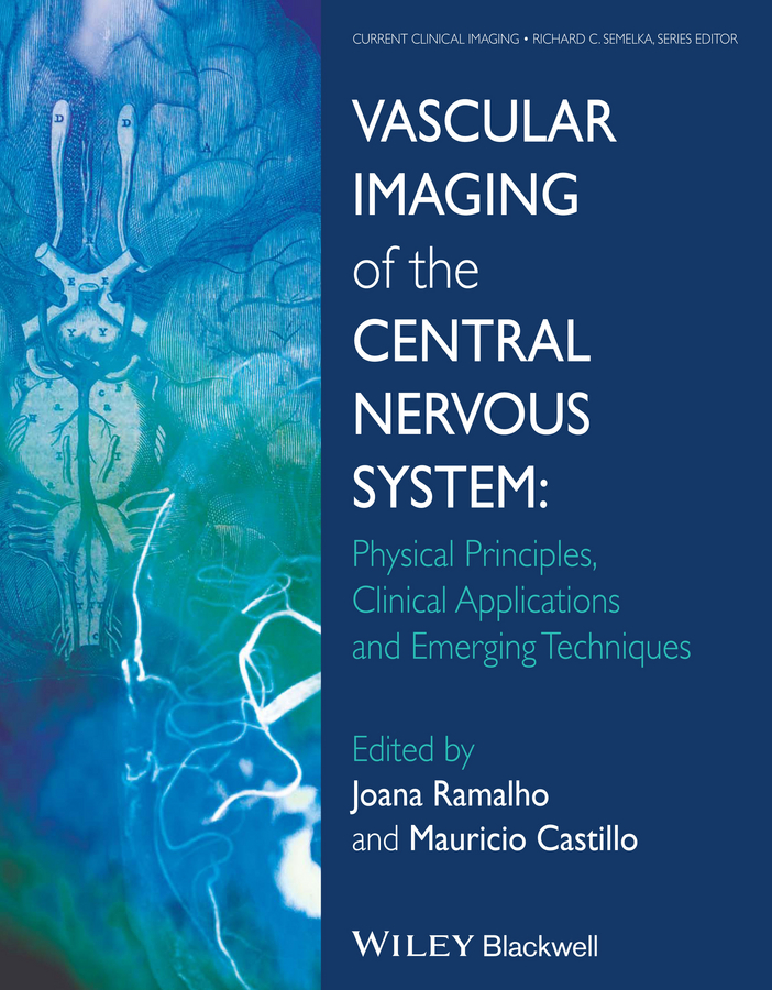Обложка книги «Vascular Imaging of the Central Nervous System. Physical Principles, Clinical Applications, and Emerging Techniques»