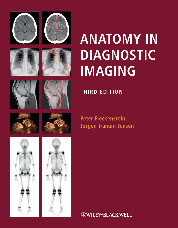 Обложка книги «Anatomy in Diagnostic Imaging»