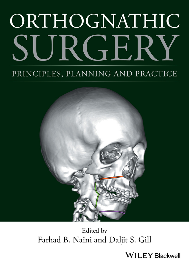 Обложка книги «Orthognathic Surgery. Principles, Planning and Practice»