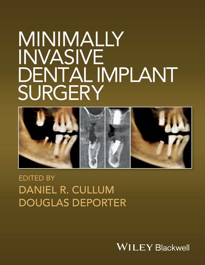 Обложка книги «Minimally Invasive Dental Implant Surgery»