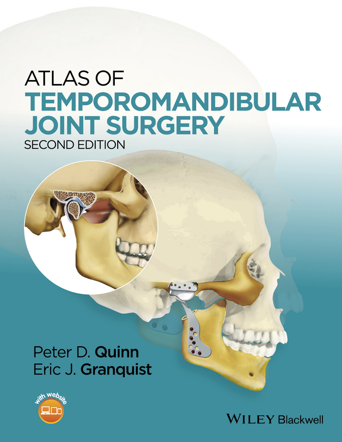 Обложка книги «Atlas of Temporomandibular Joint Surgery»