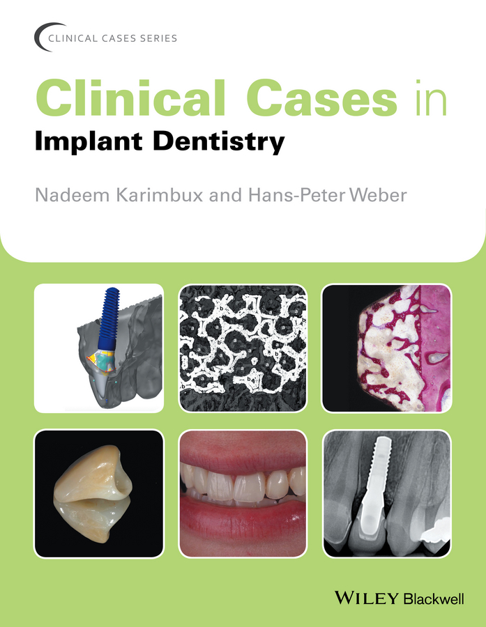 Обложка книги «Clinical Cases in Implant Dentistry»