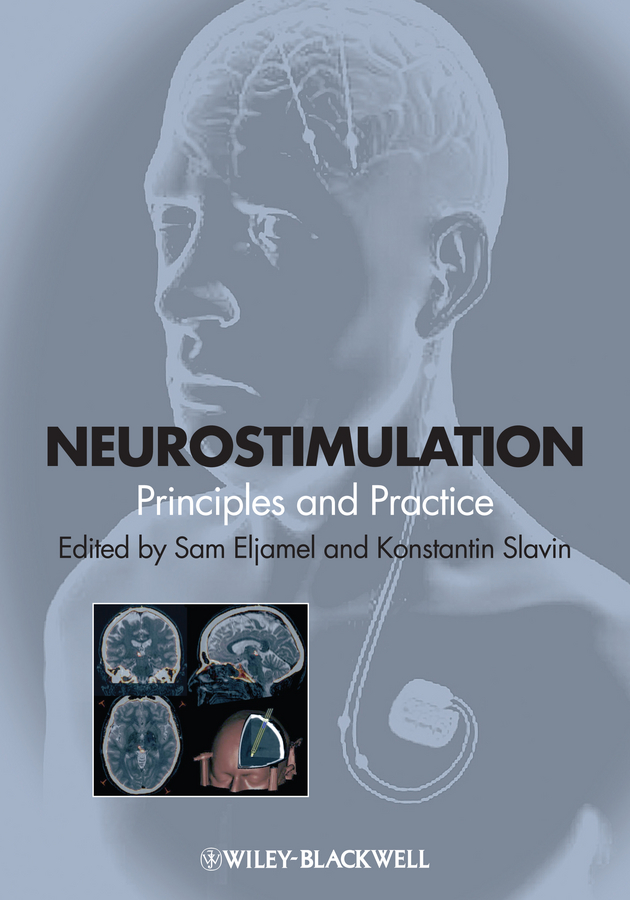 Обложка книги «Neurostimulation. Principles and Practice»