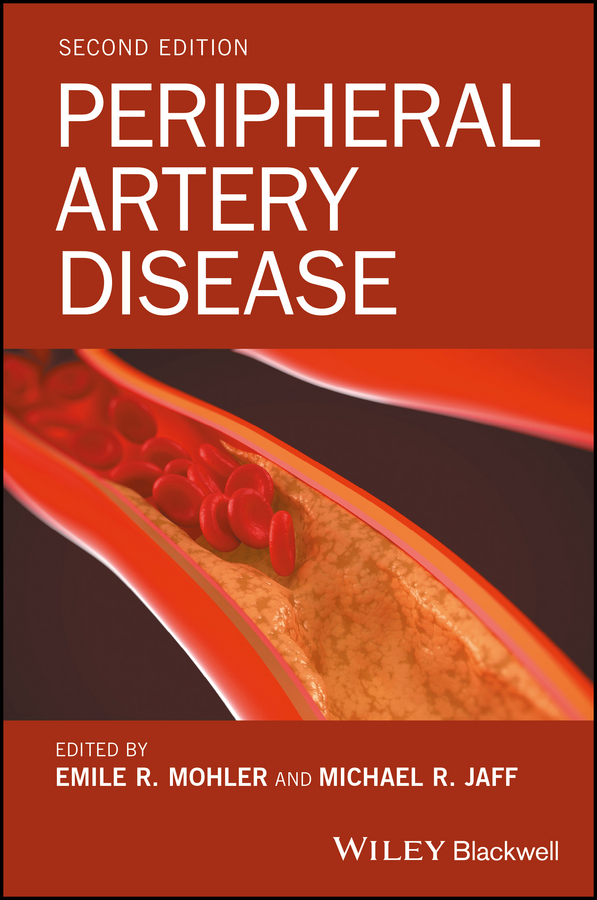Обложка книги «Peripheral Artery Disease»